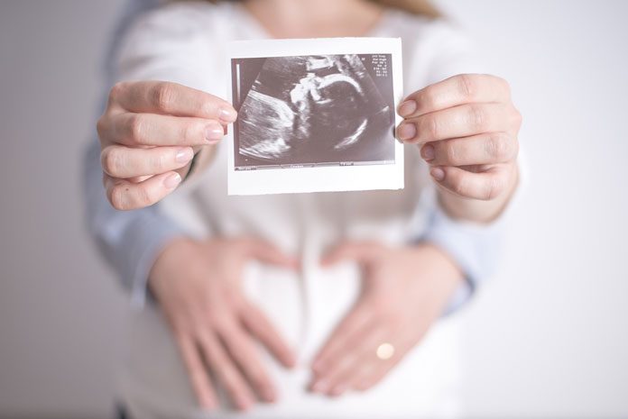 Schwangere zeigt Ultraschall-Bild